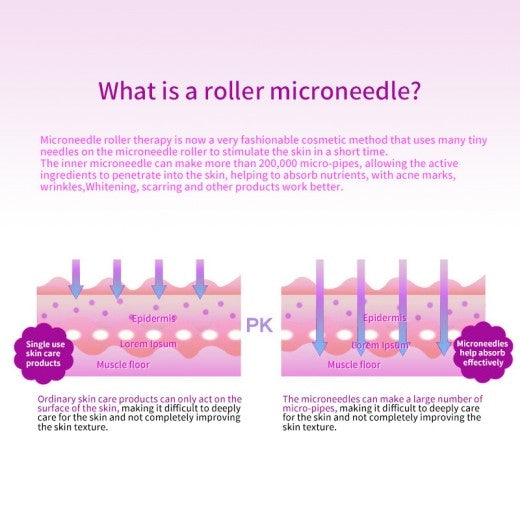 540 Needles Derma Roller 0.75MM
